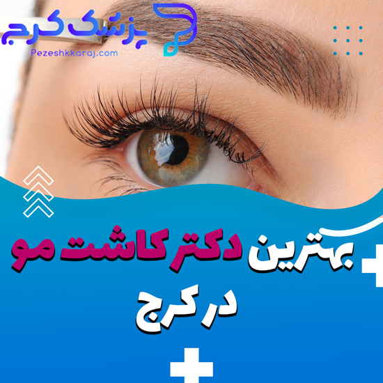 The-best-eyebrow-transplant-doctor-in-Karaj.jpg