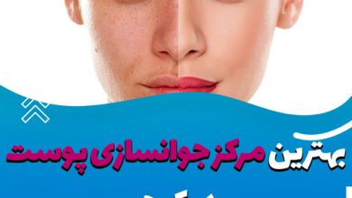 مرکز جوانسازی پوست در کرج